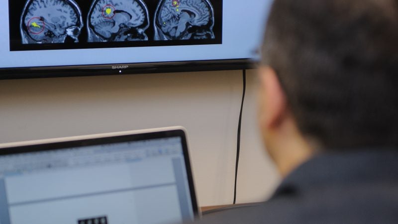 Man sitting at a desk looking at brain images