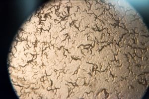 microscopic view of C. elegans, a type of roundworm